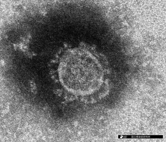新型コロナウイルス　画像提供：国立感染症研究所